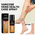 Varicose Veins Spray 鈥� Natural Herbal Formula for Fast Relief