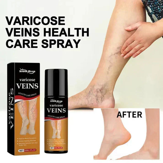 Varicose Veins Spray 鈥� Natural Herbal Formula for Fast Relief