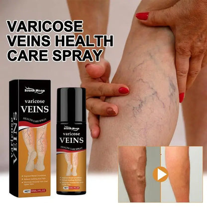 Varicose Veins Spray 鈥� Natural Herbal Formula for Fast Relief